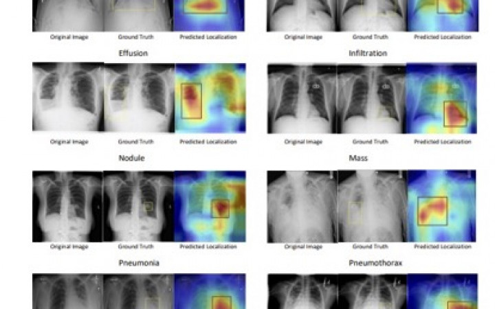 SCALP - Supervised Contrastive Learning for Cardiopulmonary Disease Classification and Localization in Chest X-rays using Patient Metadata