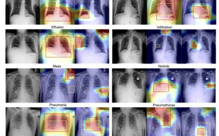 Knowledge-Augmented Contrastive Learning for Abnormality Classification and Localization in Chest X-rays with Radiomics using a Feedback Loop