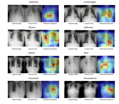 SCALP - Supervised Contrastive Learning for Cardiopulmonary Disease Classification and Localization in Chest X-rays using Patient Metadata