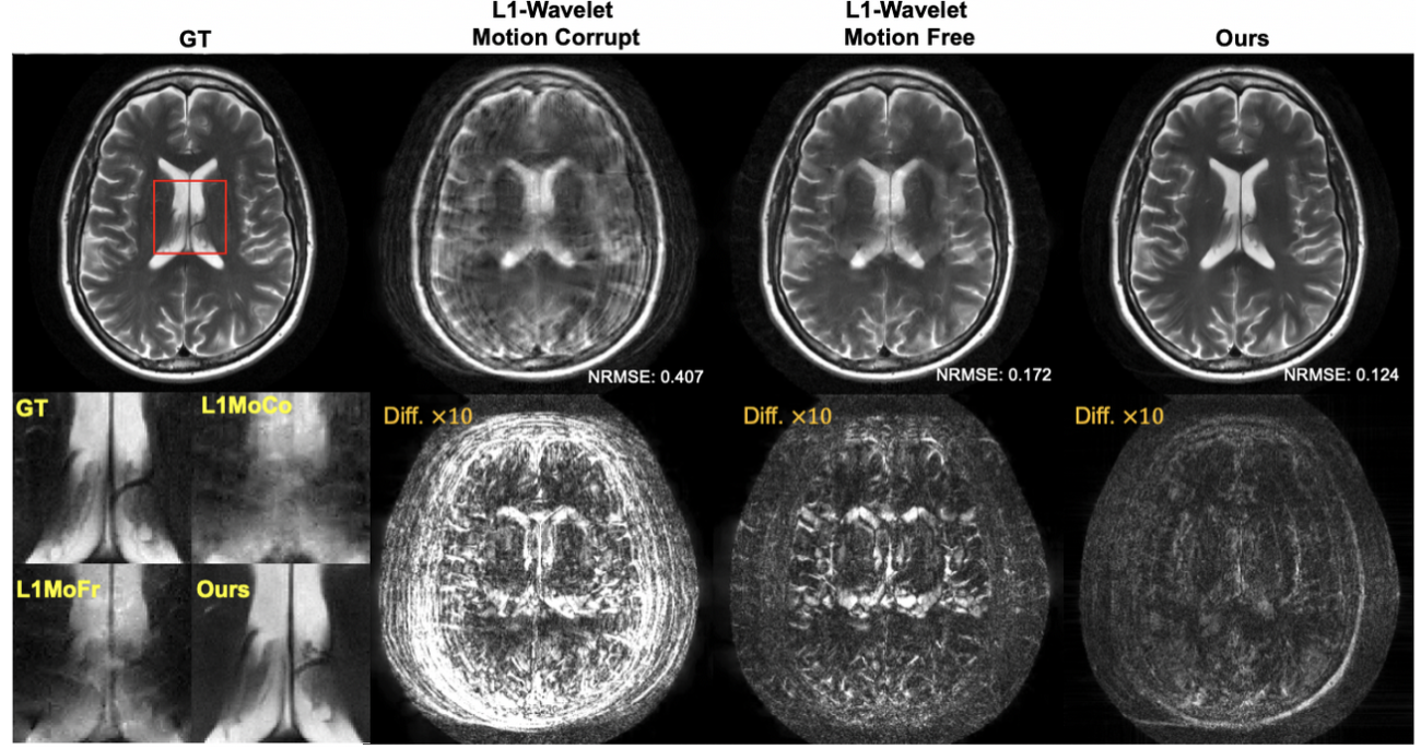 Generative MRI