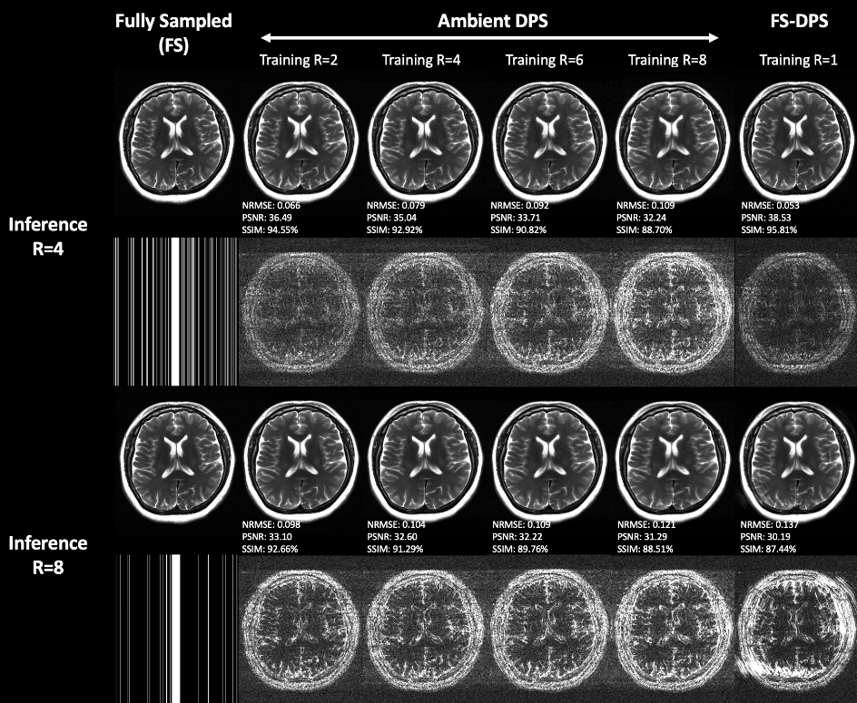 ambient_mri.png